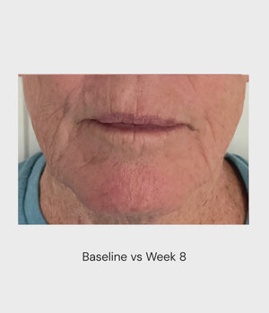 Before and after video of woman's progress from using anti-aging skincare