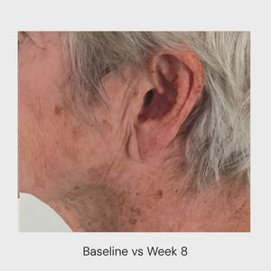 Rejuvenating Complex